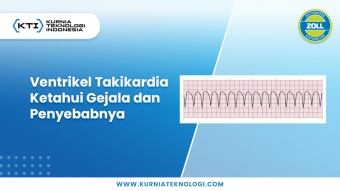 Ventrikel Takikardia - Ketahui Gejala dan Penyebabnya 