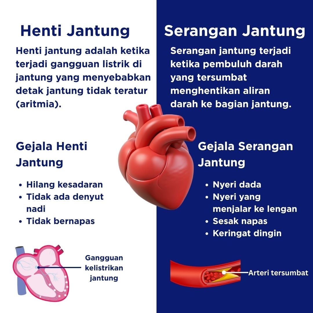 Perbedaan Serangan Jantung Dan Henti Jantung