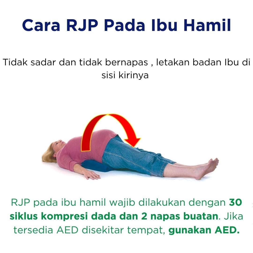 Cara RJP Pada Ibu Hamil