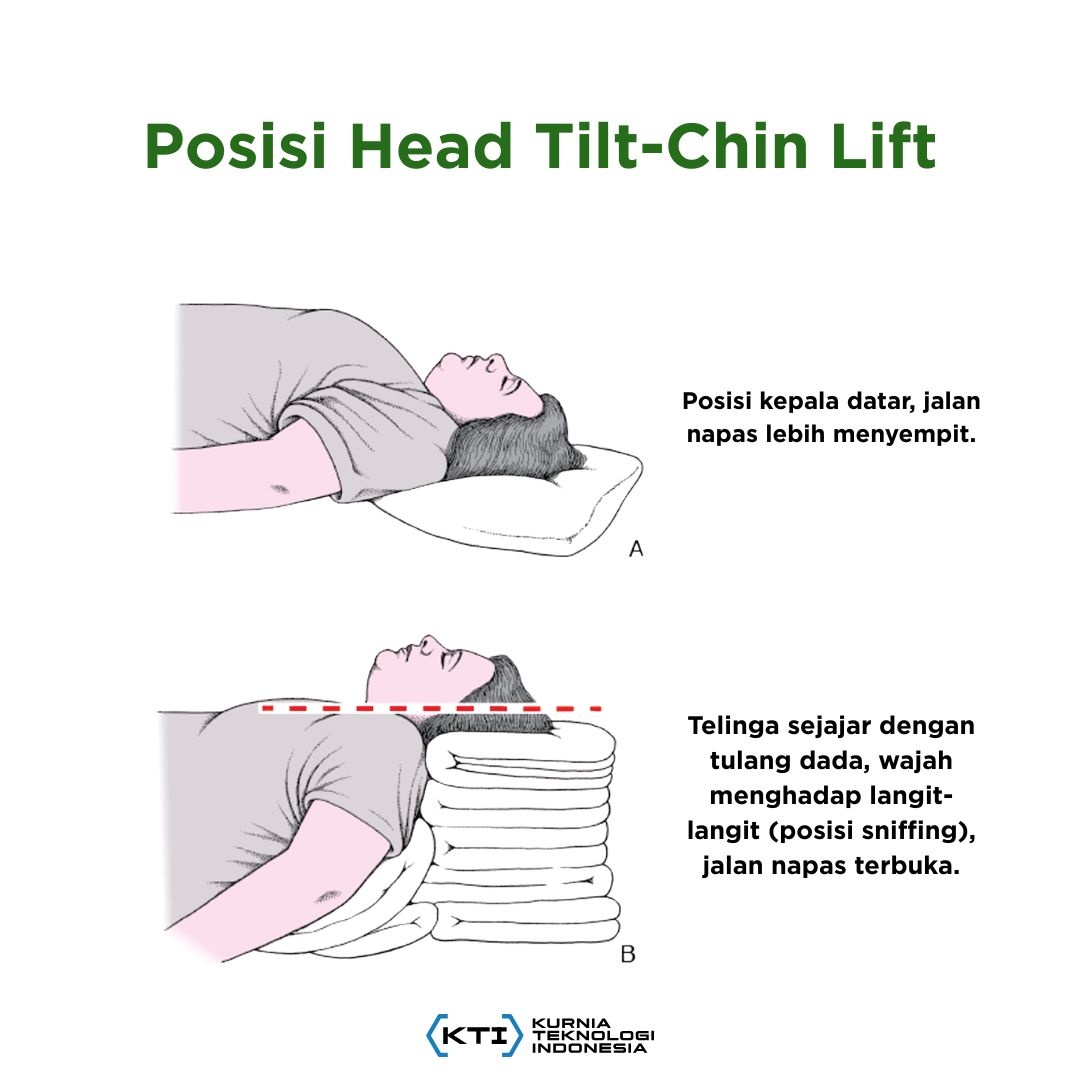 Posisi head tilt chin lift